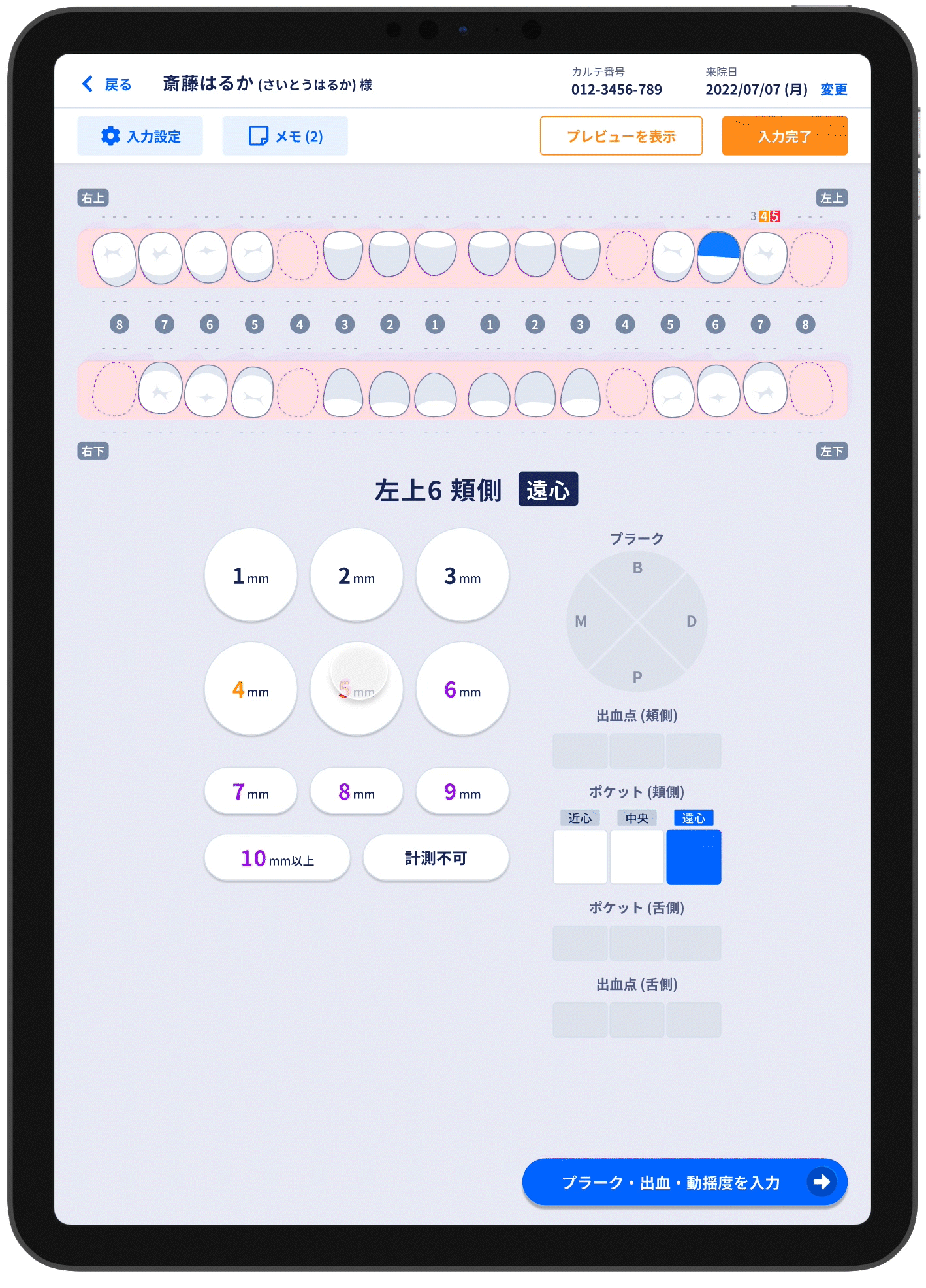 歯周病検査の数値を連続入力するタブレットUI