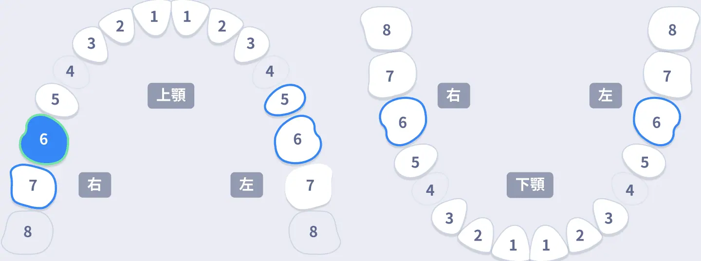顎全体をイラストで表示した案