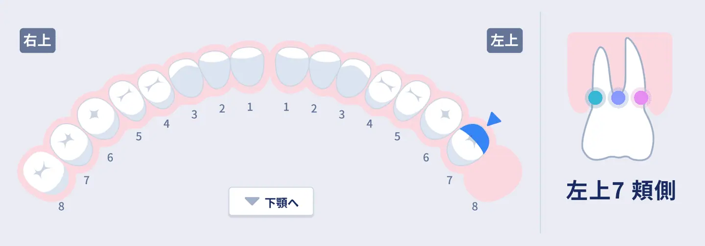 入力中の歯面を表示した案